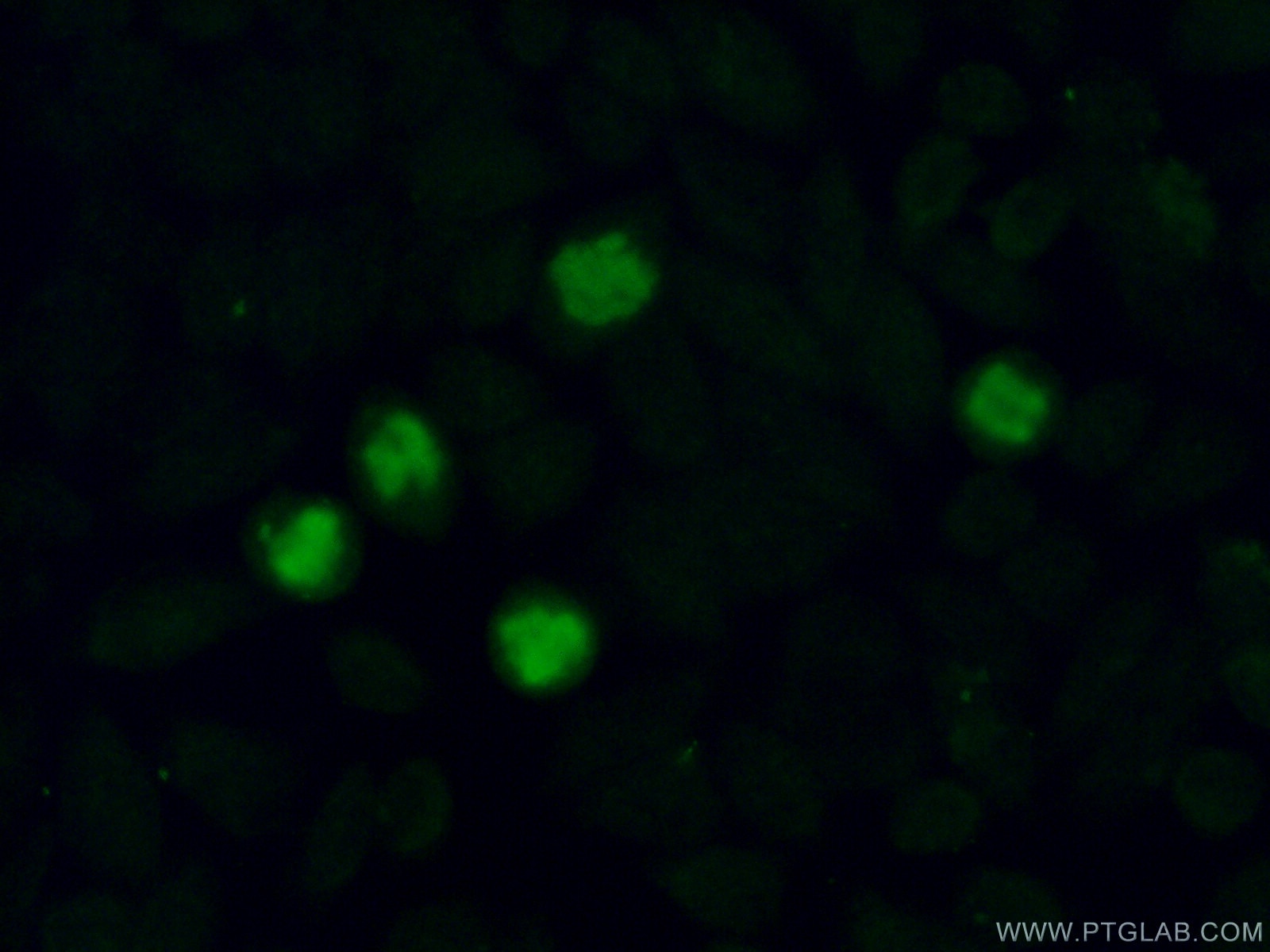 Immunofluorescence (IF) / fluorescent staining of HeLa cells using MMS19 Polyclonal antibody (16015-1-AP)