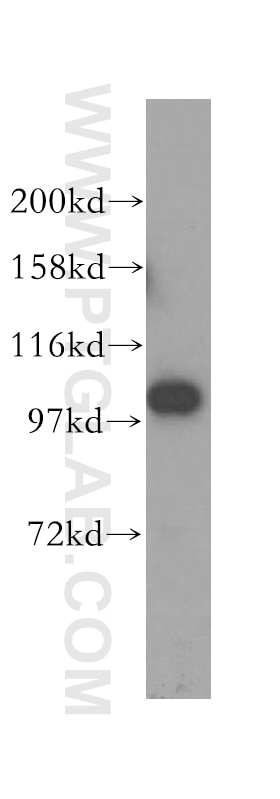 Western Blot (WB) analysis of human brain tissue using MMS19 Polyclonal antibody (16015-1-AP)