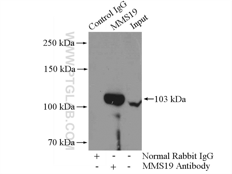 Immunoprecipitation (IP) experiment of mouse brain tissue using MMS19 Monoclonal antibody (66049-1-Ig)