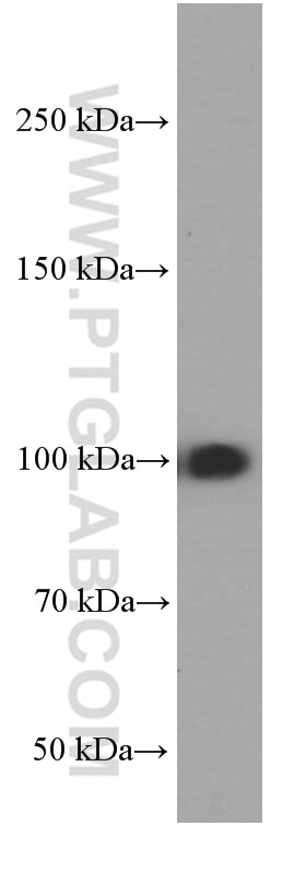 Western Blot (WB) analysis of HeLa cells using MMS19 Monoclonal antibody (66049-1-Ig)