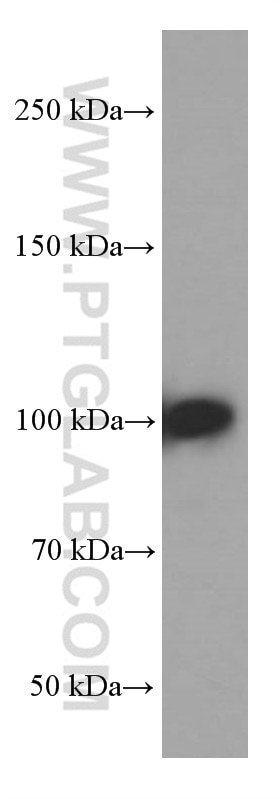 Western Blot (WB) analysis of fetal human brain tissue using MMS19 Monoclonal antibody (66049-1-Ig)