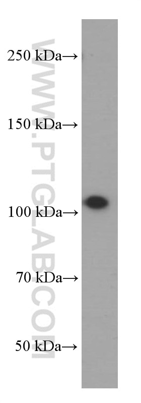 Western Blot (WB) analysis of rat brain tissue using MMS19 Monoclonal antibody (66049-1-Ig)