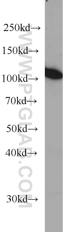 Western Blot (WB) analysis of human brain tissue using MMS19 Monoclonal antibody (66049-1-Ig)