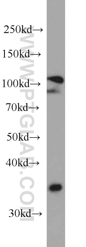 Western Blot (WB) analysis of HepG2 cells using MMS19 Monoclonal antibody (66049-1-Ig)