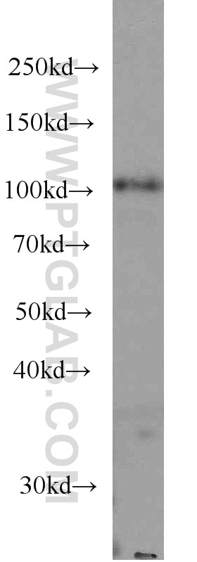 Western Blot (WB) analysis of human kidney tissue using MMS19 Monoclonal antibody (66049-1-Ig)