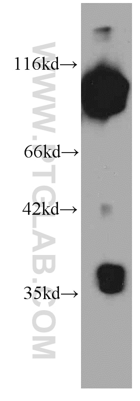 Western Blot (WB) analysis of HepG2 cells using MMS19 Monoclonal antibody (66049-1-Ig)