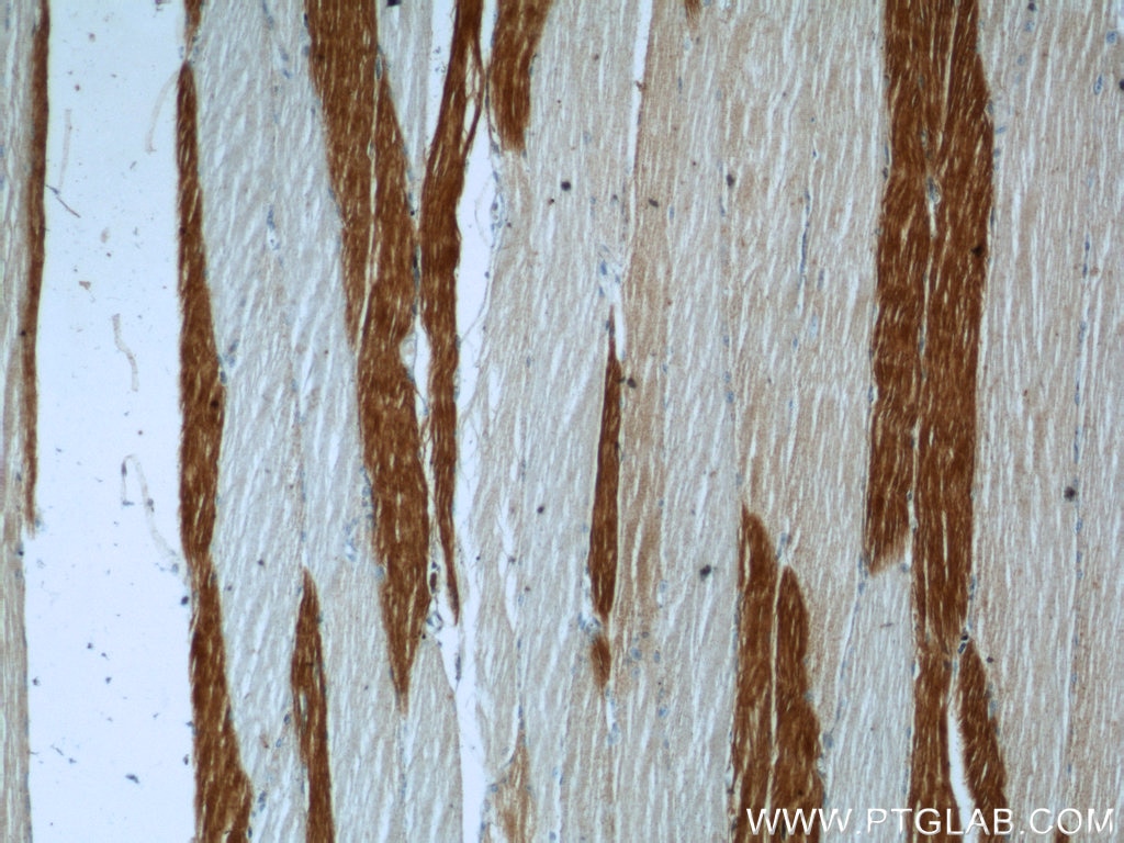 Immunohistochemistry (IHC) staining of human skeletal muscle tissue using MN1 Polyclonal antibody (24697-1-AP)