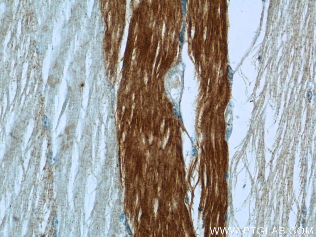 Immunohistochemistry (IHC) staining of human skeletal muscle tissue using MN1 Polyclonal antibody (24697-1-AP)