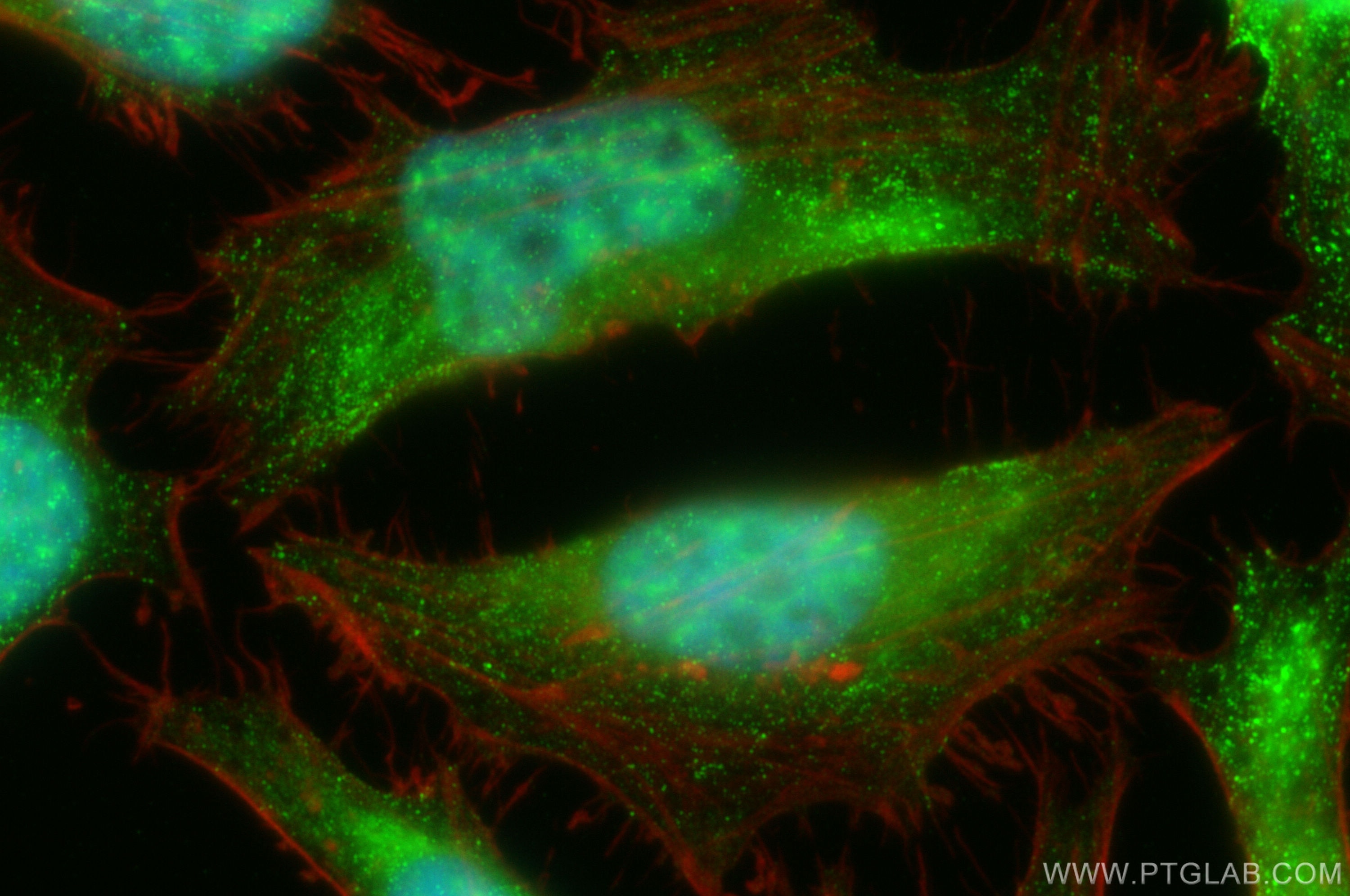 Immunofluorescence (IF) / fluorescent staining of HeLa cells using MNAT1 Polyclonal antibody (11719-1-AP)