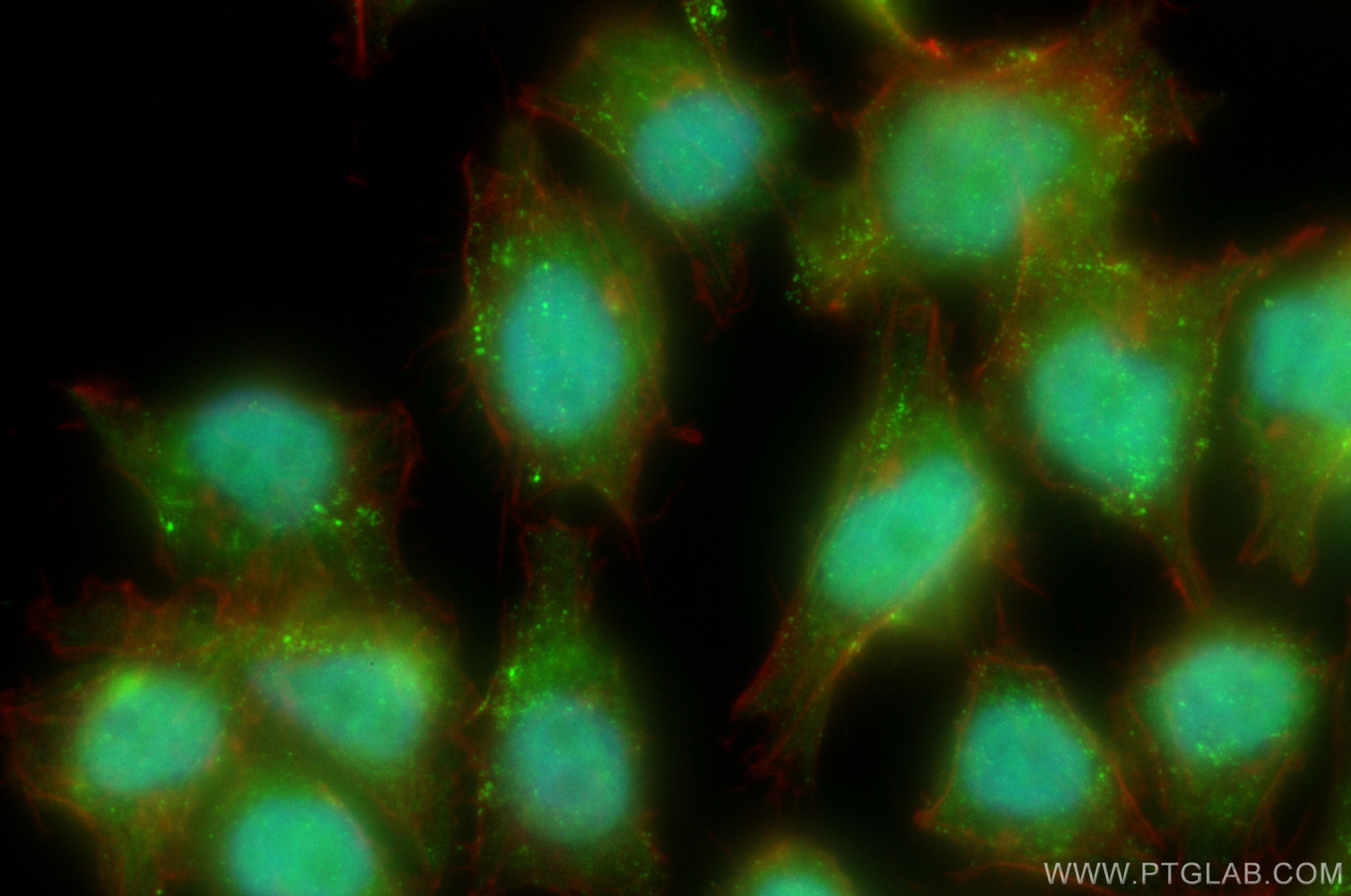 Immunofluorescence (IF) / fluorescent staining of A375 cells using MNAT1 Polyclonal antibody (11719-1-AP)