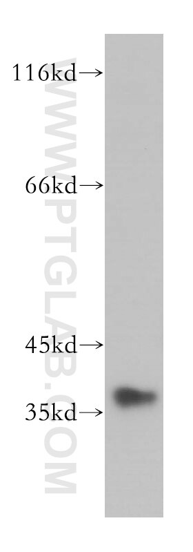 Western Blot (WB) analysis of NIH/3T3 cells using MNAT1 Polyclonal antibody (11719-1-AP)