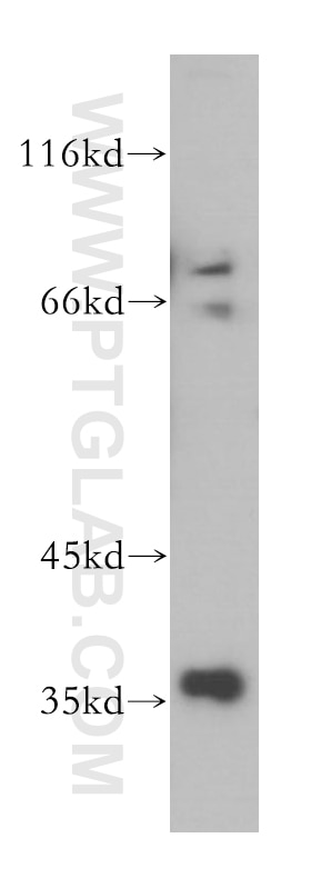 Western Blot (WB) analysis of A375 cells using MNAT1 Polyclonal antibody (11719-1-AP)