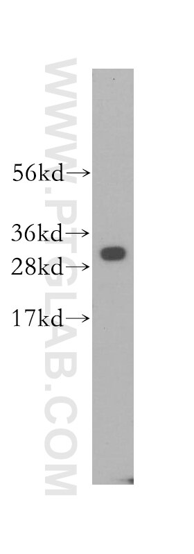 Western Blot (WB) analysis of human kidney tissue using MND1 Polyclonal antibody (11636-1-AP)