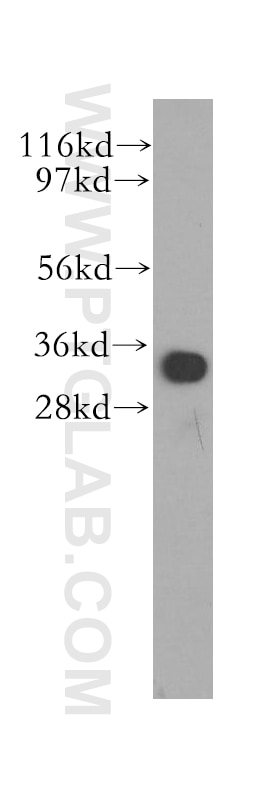 Western Blot (WB) analysis of human liver tissue using MND1 Polyclonal antibody (11636-1-AP)