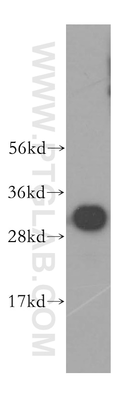 Western Blot (WB) analysis of human liver tissue using MND1 Polyclonal antibody (11636-1-AP)