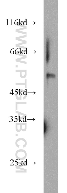 Western Blot (WB) analysis of human bladder tissue using MNDA Polyclonal antibody (13576-1-AP)