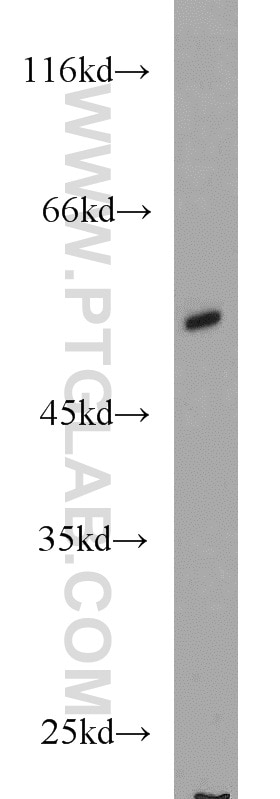 Western Blot (WB) analysis of HL-60 cells using MNDA Polyclonal antibody (13576-1-AP)