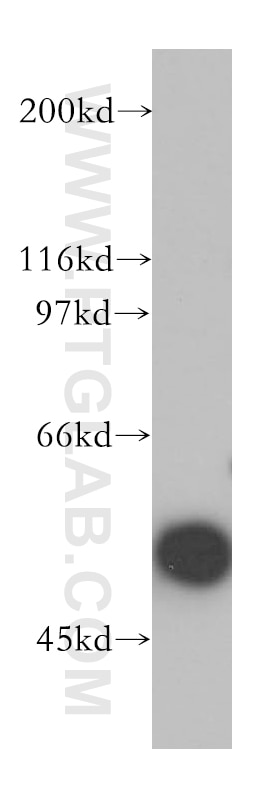 Western Blot (WB) analysis of K-562 cells using MNDA Polyclonal antibody (13576-1-AP)