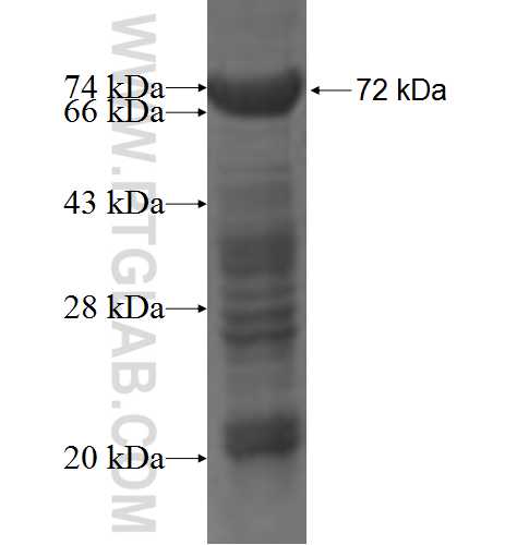 MNDA fusion protein Ag4476 SDS-PAGE