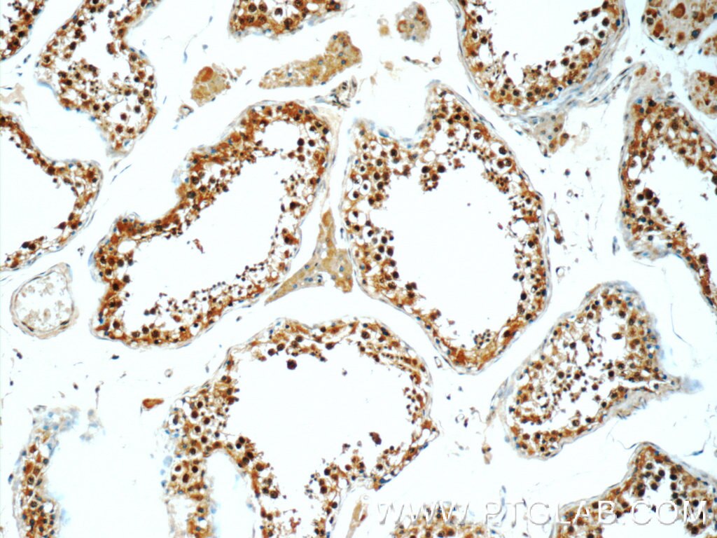 Immunohistochemistry (IHC) staining of human testis tissue using MNS1 Polyclonal antibody (12693-1-AP)