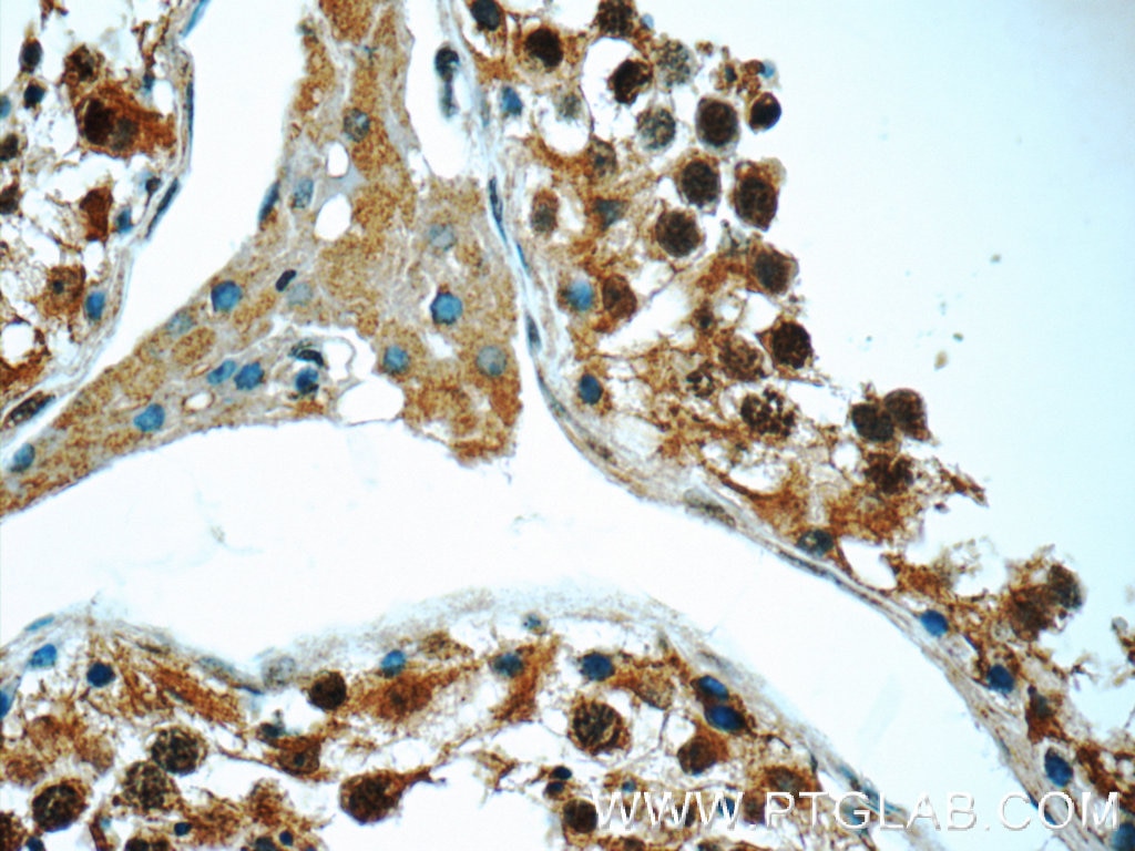 Immunohistochemistry (IHC) staining of human testis tissue using MNS1 Polyclonal antibody (12693-1-AP)