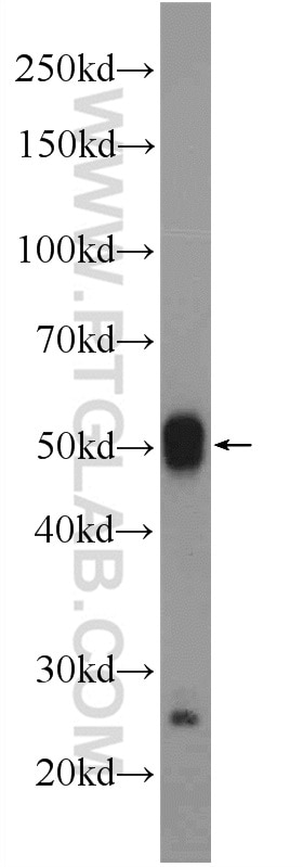 Western Blot (WB) analysis of rat testis tissue using MNS1 Polyclonal antibody (12693-1-AP)