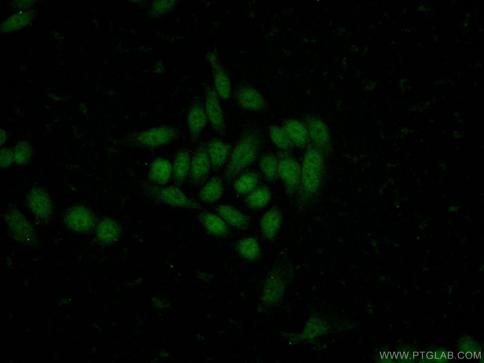 Immunofluorescence (IF) / fluorescent staining of HeLa cells using MNT Polyclonal antibody (23742-1-AP)