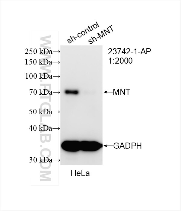 Western Blot (WB) analysis of HeLa cells using MNT Polyclonal antibody (23742-1-AP)
