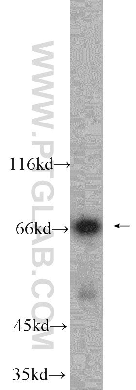 Western Blot (WB) analysis of HeLa cells using MNT Polyclonal antibody (23742-1-AP)