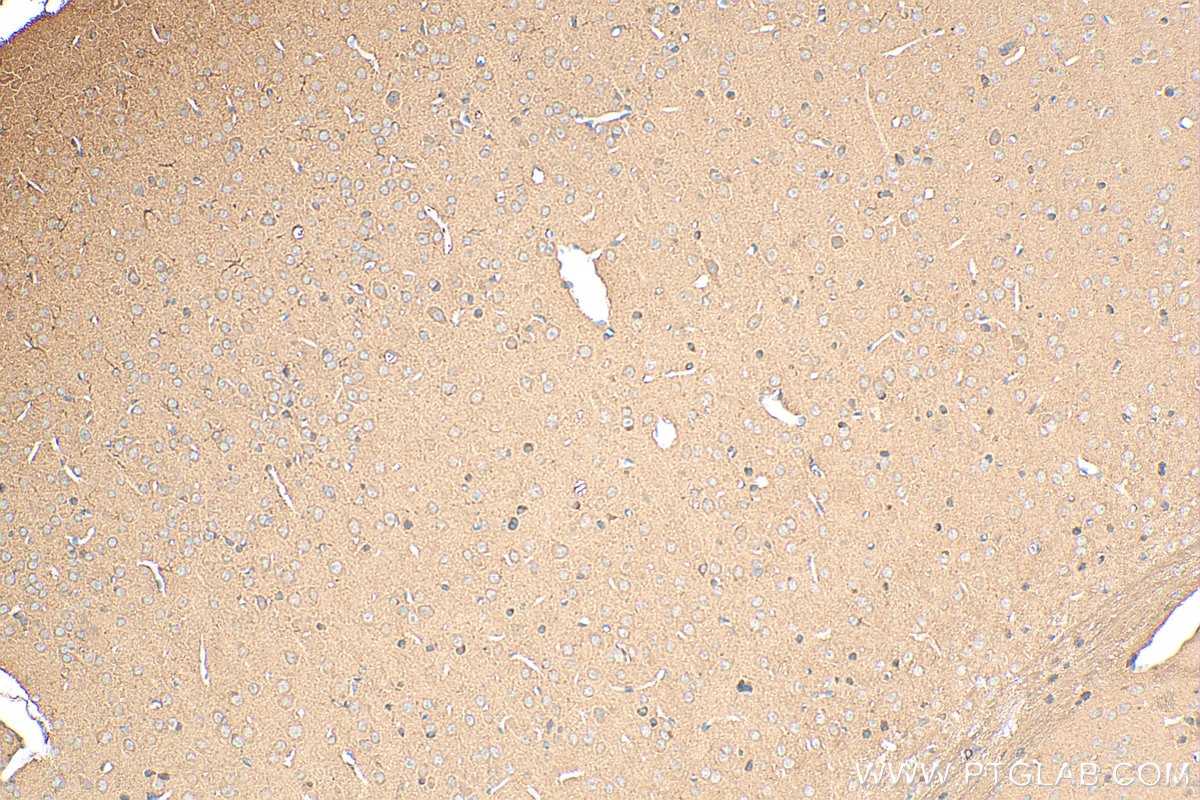 Immunohistochemistry (IHC) staining of mouse brain tissue using MOAP1 Polyclonal antibody (15325-1-AP)