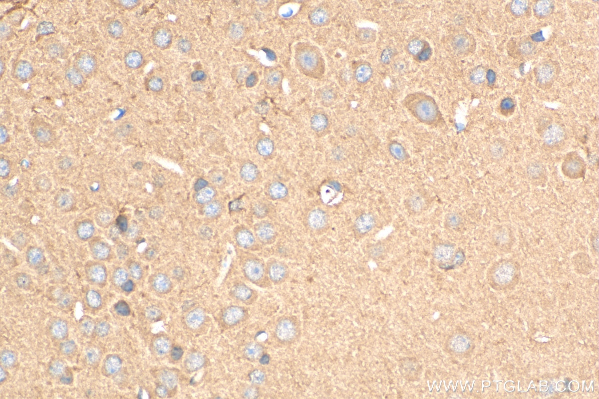IHC staining of mouse brain using 15325-1-AP
