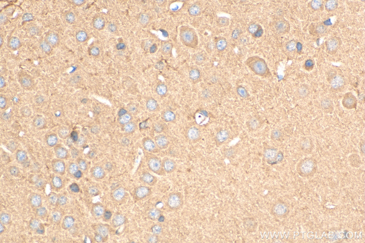 Immunohistochemistry (IHC) staining of mouse brain tissue using MOAP1 Polyclonal antibody (15325-1-AP)