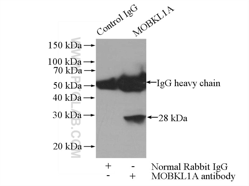Immunoprecipitation (IP) experiment of Jurkat cells using MOBKL1A Polyclonal antibody (12790-1-AP)