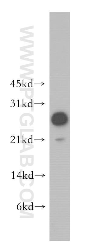 Western Blot (WB) analysis of Jurkat cells using MOBKL1A Polyclonal antibody (12790-1-AP)