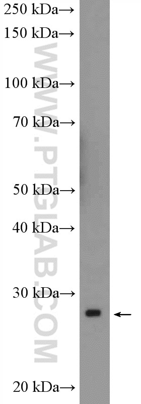 WB analysis of K-562 using 11669-1-AP