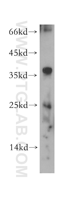Western Blot (WB) analysis of Raji cells using MOBKL1B Polyclonal antibody (11669-1-AP)