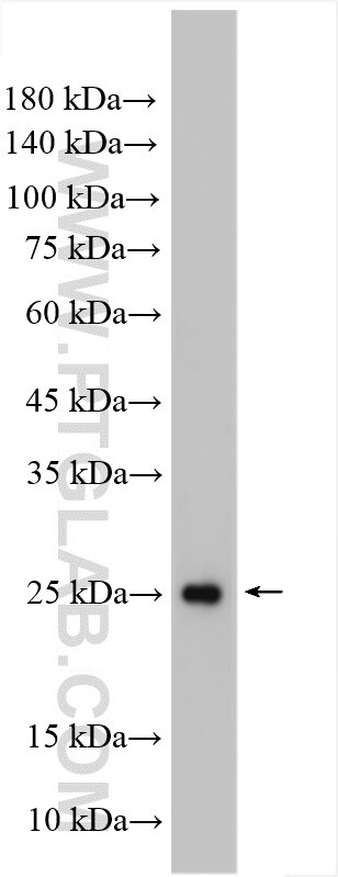 WB analysis of Jurkat using 16942-1-AP (same clone as 16942-1-PBS) Western Blot (WB) analysis of Jurkat cells using MOBKL2A Polyclonal antibody (16942-1-AP)