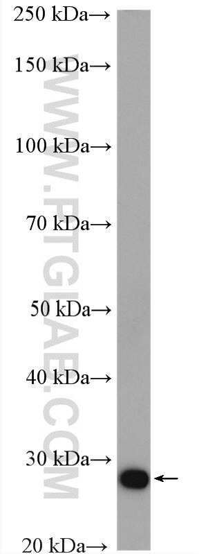 WB analysis of mouse thymus using 16942-1-AP