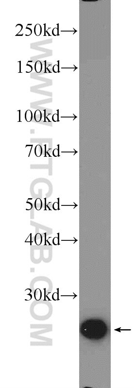 Western Blot (WB) analysis of mouse thymus tissue using MOBKL2A Polyclonal antibody (16942-1-AP)