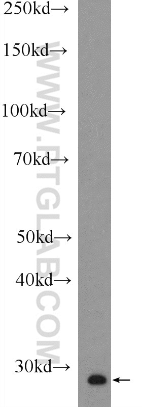 Western Blot (WB) analysis of Jurkat cells using MOBKL2A Polyclonal antibody (16942-1-AP)