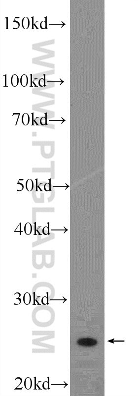 Western Blot (WB) analysis of Raji cells using MOBKL2A Polyclonal antibody (16942-1-AP)