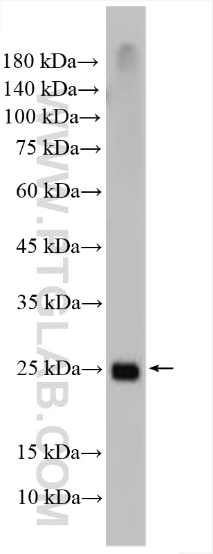 WB analysis of Raji using 16942-1-AP Western Blot (WB) analysis of Raji cells using MOBKL2A Polyclonal antibody (16942-1-AP)
