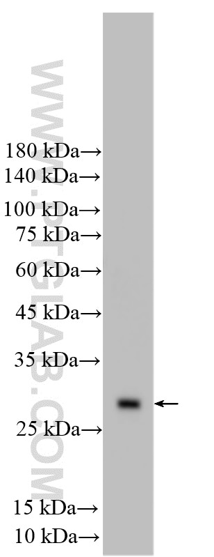 WB analysis of mouse thymus using 16942-1-AP (same clone as 16942-1-PBS) Western Blot (WB) analysis of mouse thymus tissue using MOBKL2A Polyclonal antibody (16942-1-AP)