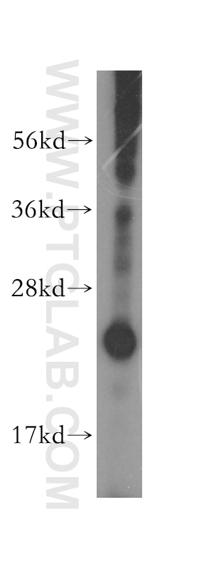Western Blot (WB) analysis of mouse lymph tissue using MOBKL2A Polyclonal antibody (16942-1-AP)