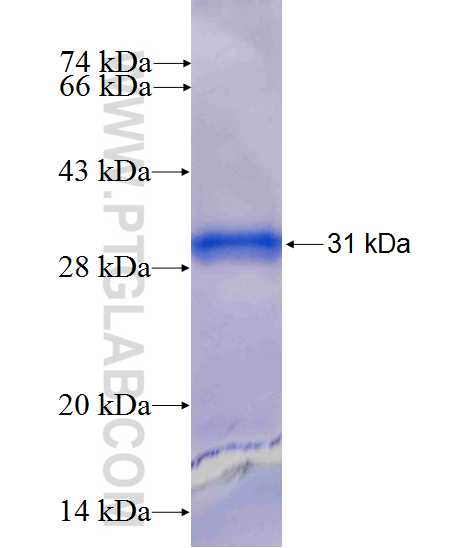 MOBKL2A fusion protein Ag10509 SDS-PAGE