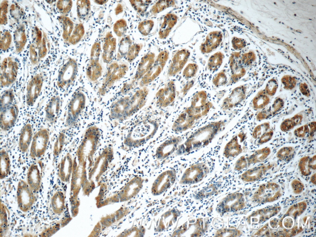 IHC staining of human stomach using 15886-1-AP