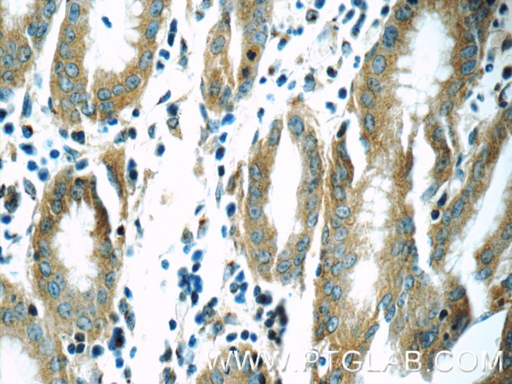 Immunohistochemistry (IHC) staining of human stomach tissue using MOBKL3 Polyclonal antibody (15886-1-AP)
