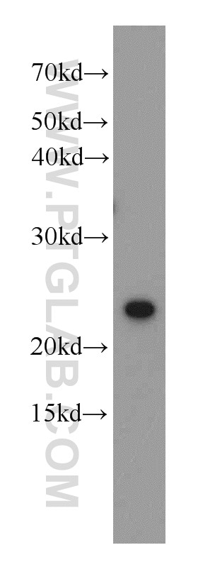 Western Blot (WB) analysis of K-562 cells using MOBKL3 Polyclonal antibody (15886-1-AP)