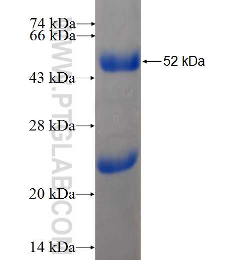 MOBKL3 fusion protein Ag8671 SDS-PAGE