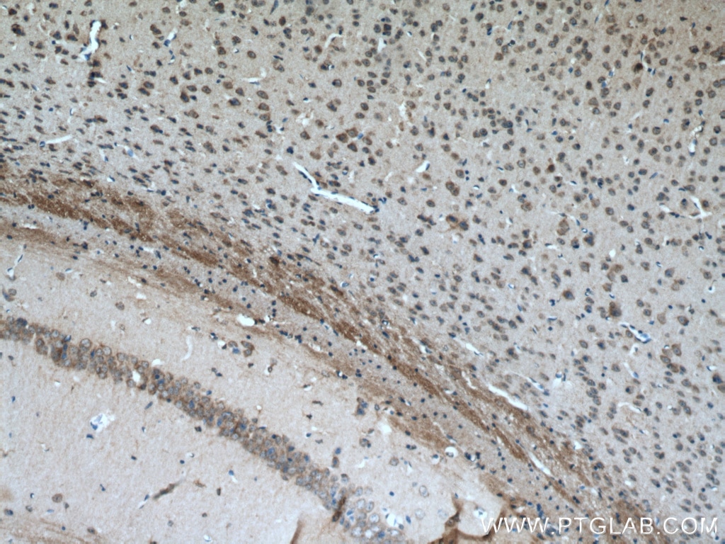 Immunohistochemistry (IHC) staining of mouse brain tissue using MOBP Polyclonal antibody (12472-1-AP)
